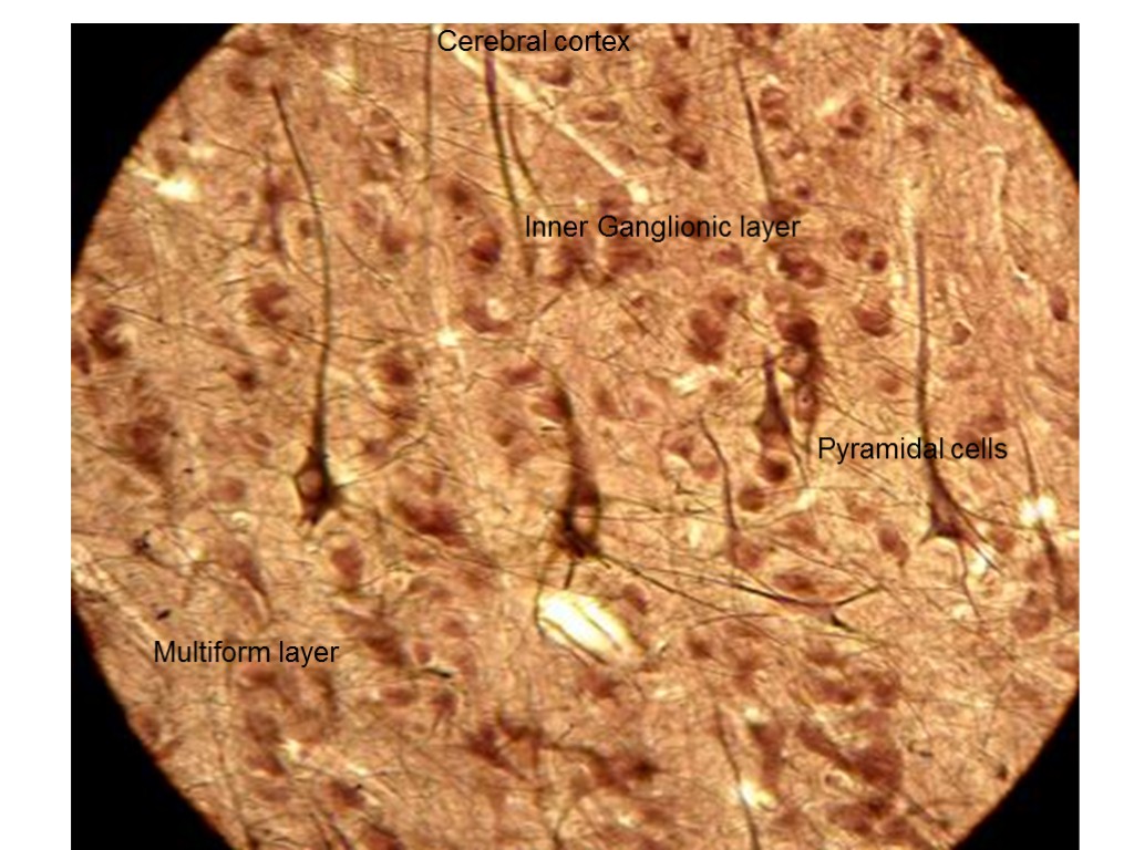 Inner Ganglionic layer Cerebral cortex Pyramidal cells Multiform layer